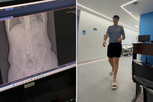 Jovem engole aliança sem querer, vai parar no hospital e viraliza na web; VÍDEO